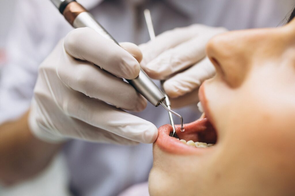 Dental implants trials
